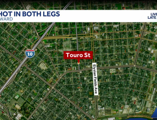 New Orleans police investigate after man shot in both legs